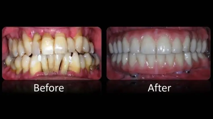 Nashua Prosthodontist Thomas Suranyi DDS MS