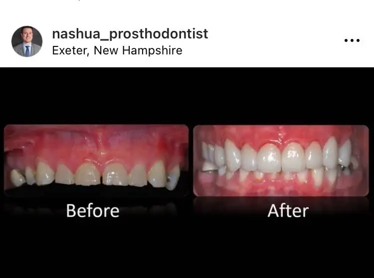 Nashua Prosthodontist Thomas Suranyi DDS MS