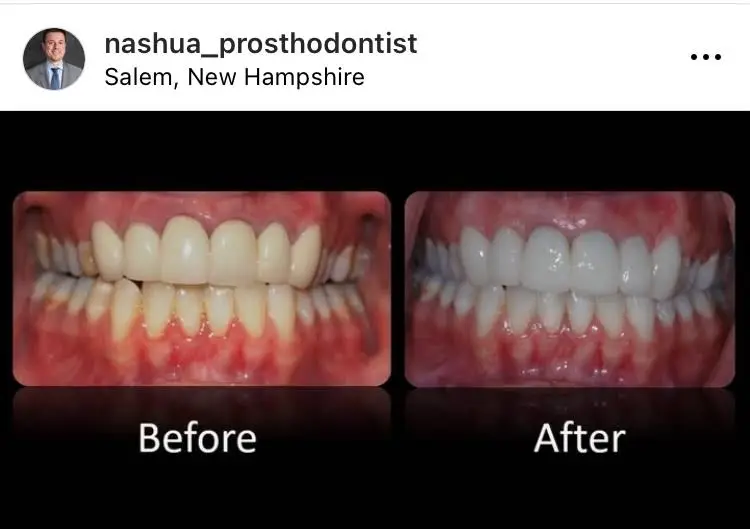Nashua Prosthodontist Thomas Suranyi DDS MS