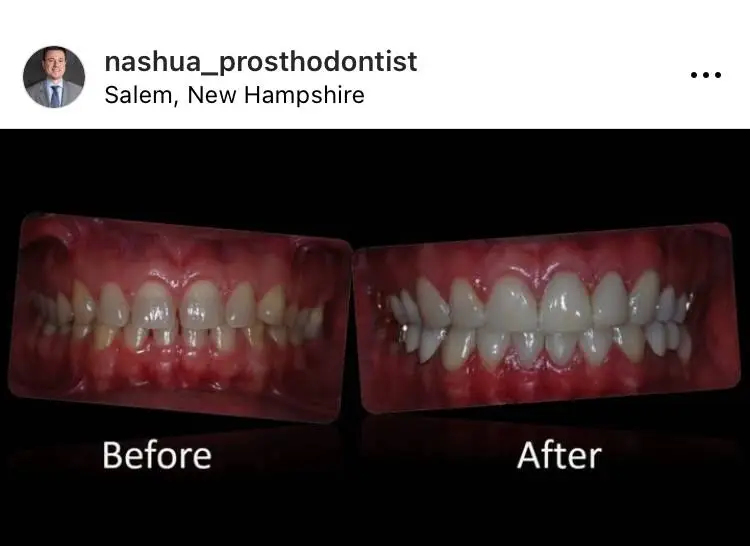 Nashua Prosthodontist Thomas Suranyi DDS MS