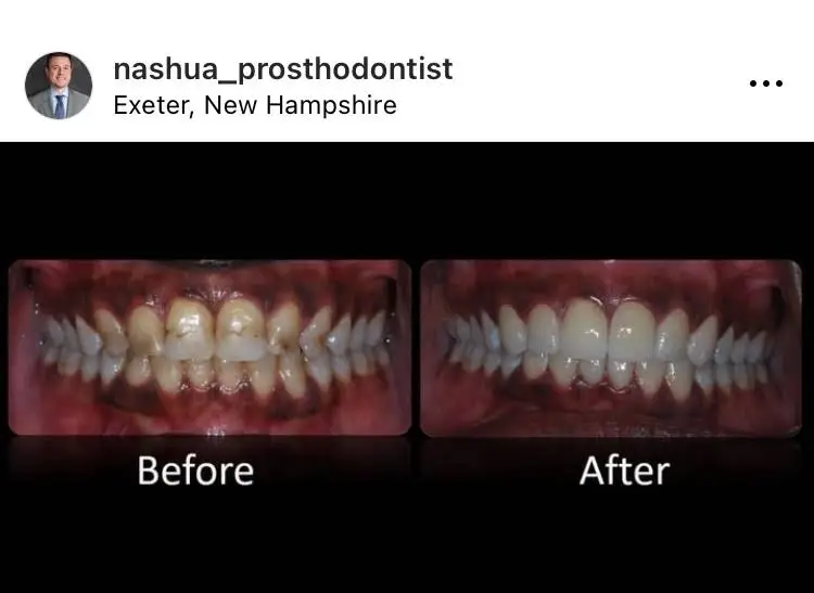 Nashua Prosthodontist Thomas Suranyi DDS MS