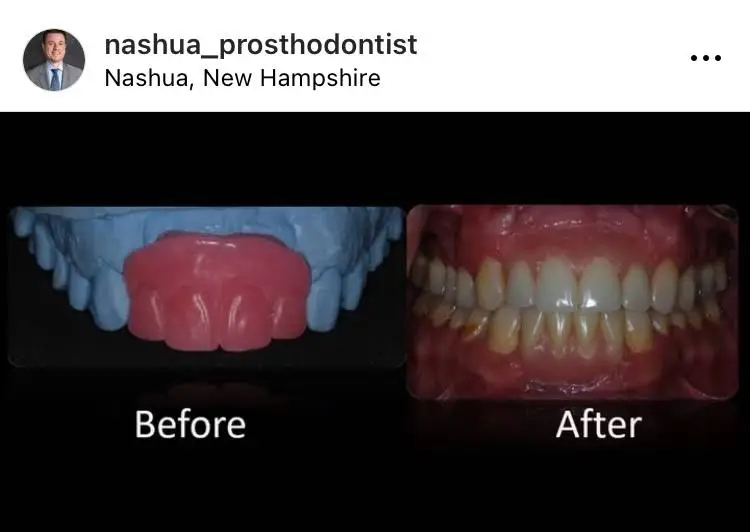 Nashua Prosthodontist Thomas Suranyi DDS MS