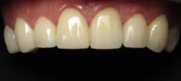 Boutselis Family Dental Care