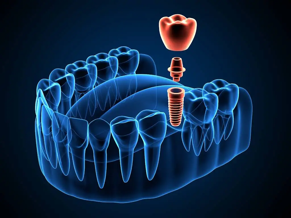 Lane Oral & Maxillofacial Surgery & Dental Implant Center