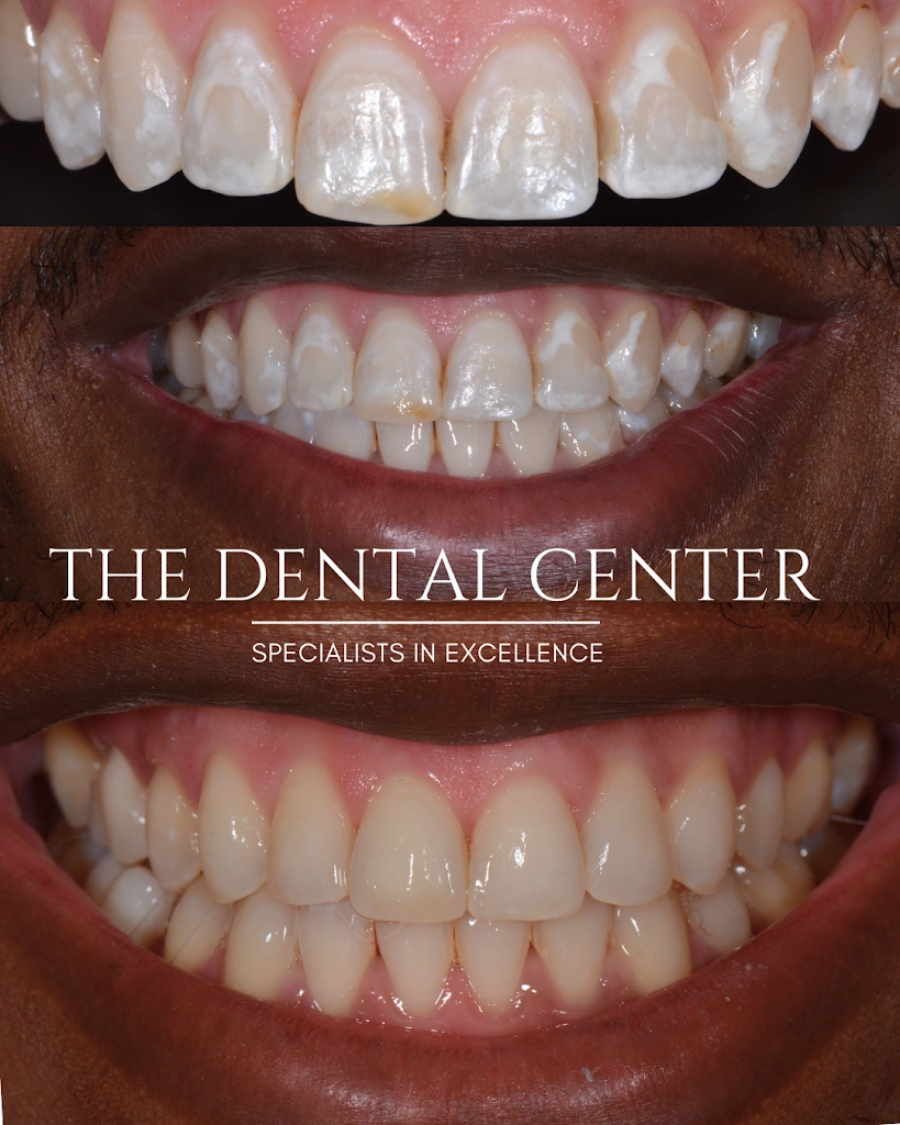 The Dental Center of Manchester