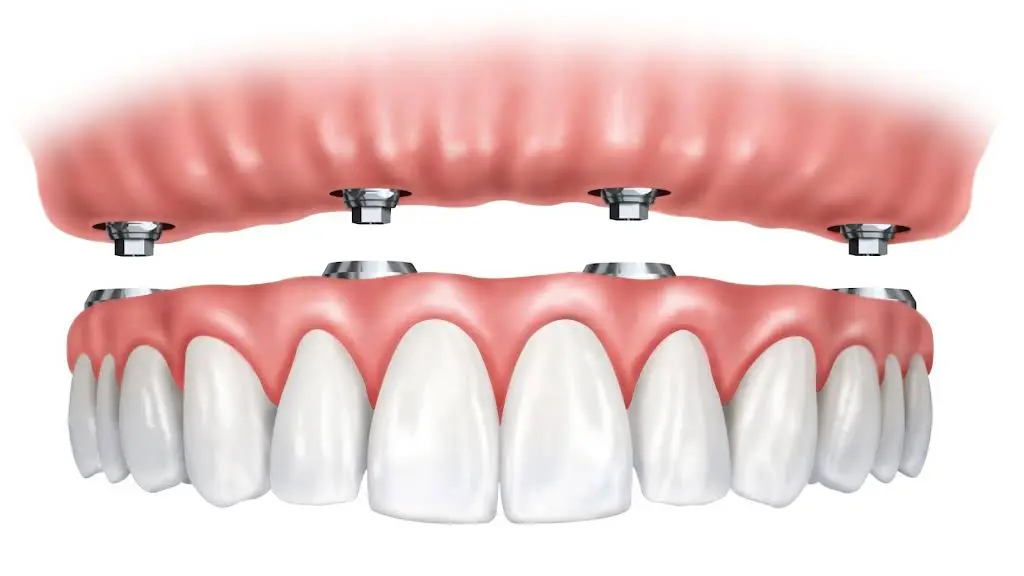 Oasis Dental