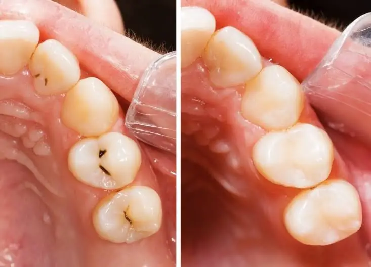 603 Dental