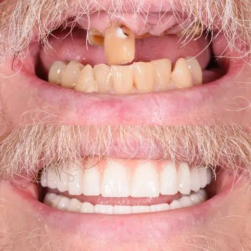 ReNEW Dental Denture and Implant Center