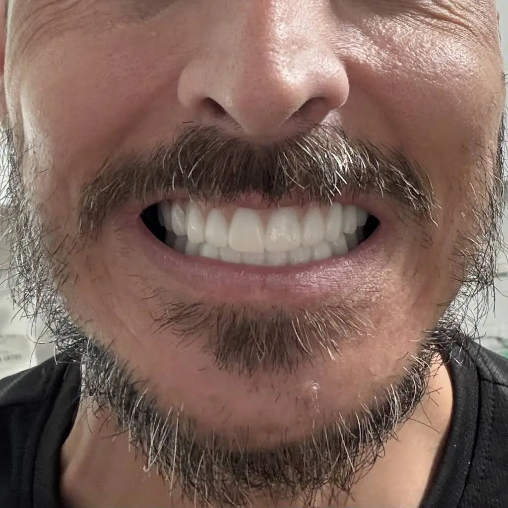 ReNEW Dental Denture and Implant Center
