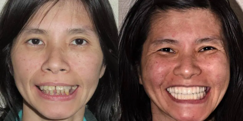 ReNEW Dental Denture and Implant Center
