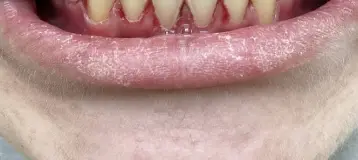 Pelletier Smiles