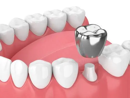 Family Dental of Pelham