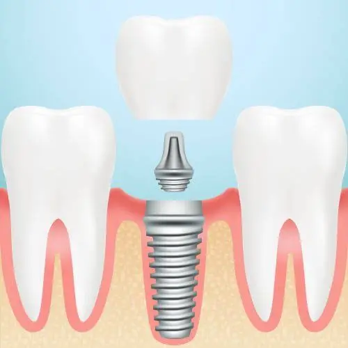 Family Dental of Pelham