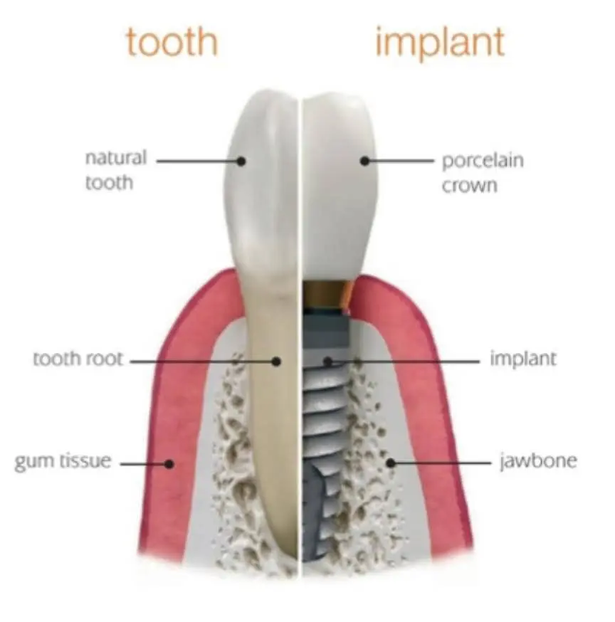 Buttonwood Dental