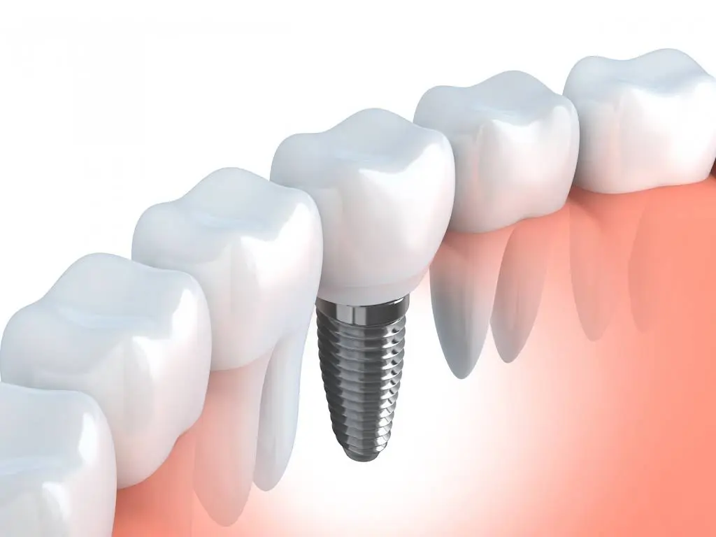 Diane Bonanni, D.M.D. - Stoneham Family and Cosmetic Dentistry
