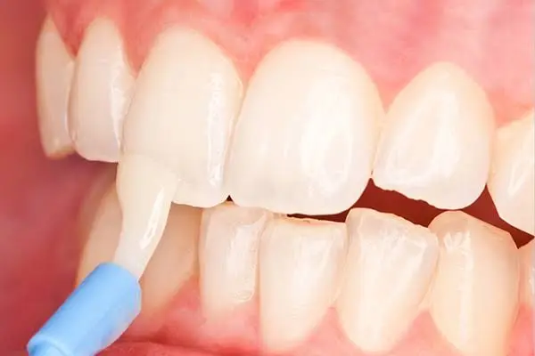 Diane Bonanni, D.M.D. - Stoneham Family and Cosmetic Dentistry