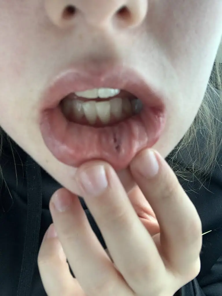 Aspen Dental