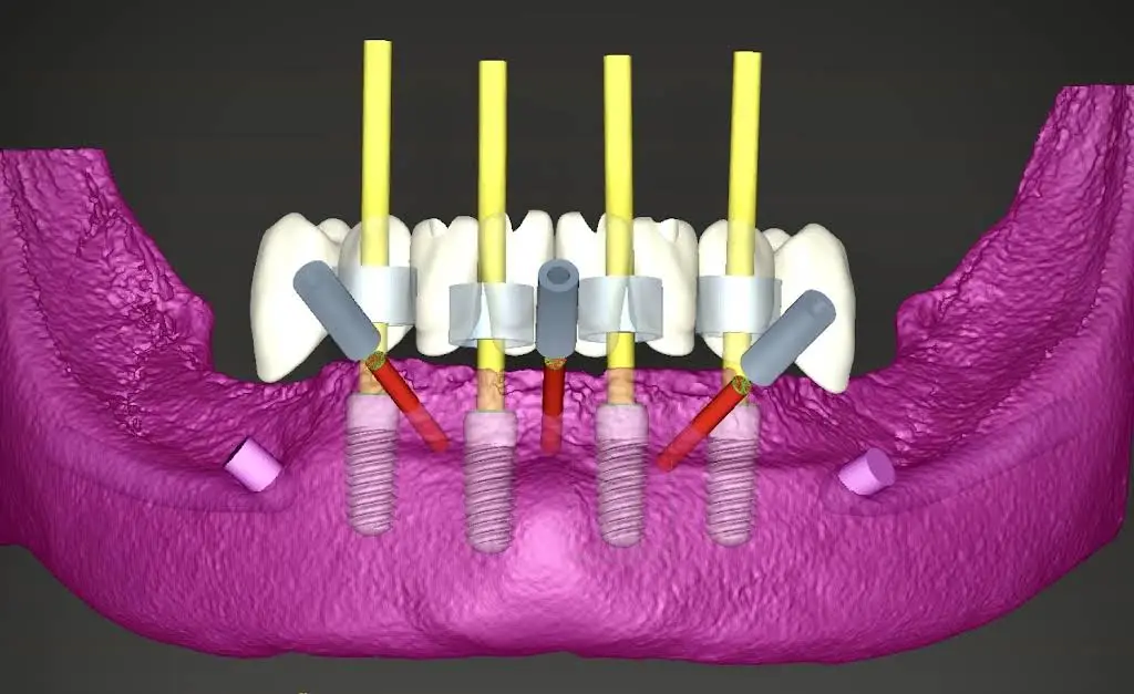 Seabreeze Dental