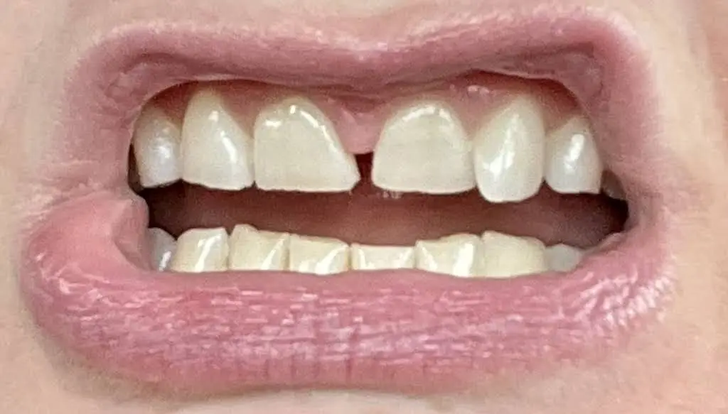 Liberty Tree Prosthodontics