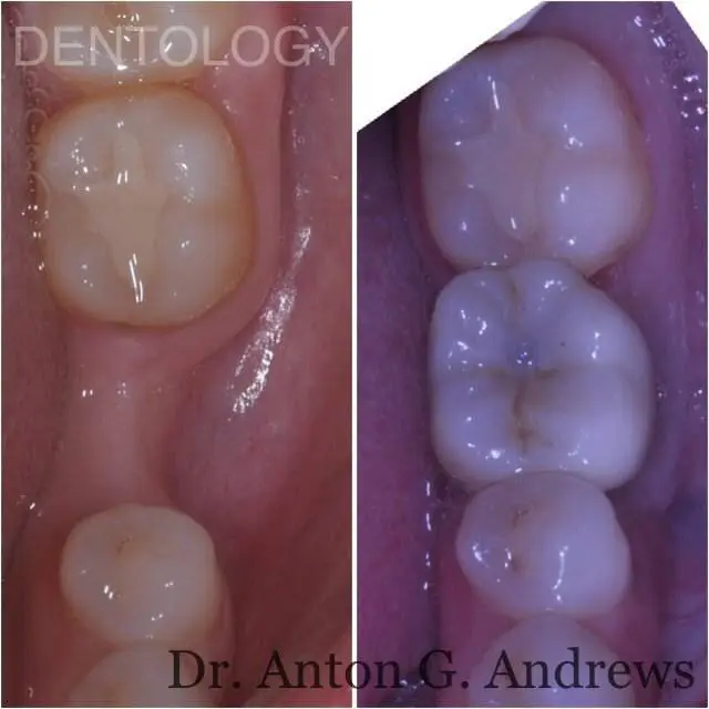 Dentology