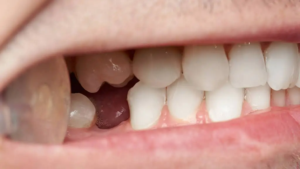 Braasch Oral Surgery