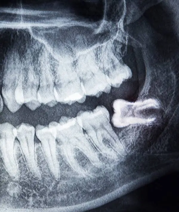 Braasch Oral Surgery