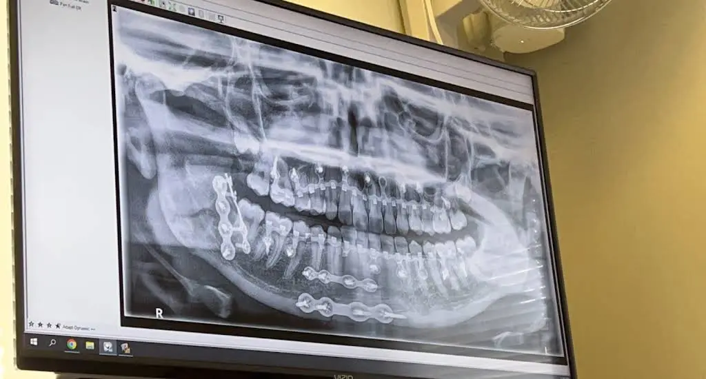NHOMS: New Hampshire Oral and Maxillofacial Surgery - Concord