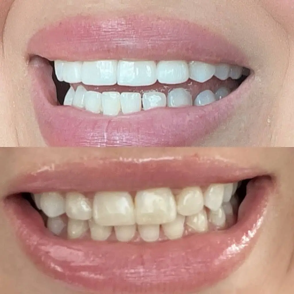 Torrisi, Burba & Maripuri Dental Associates