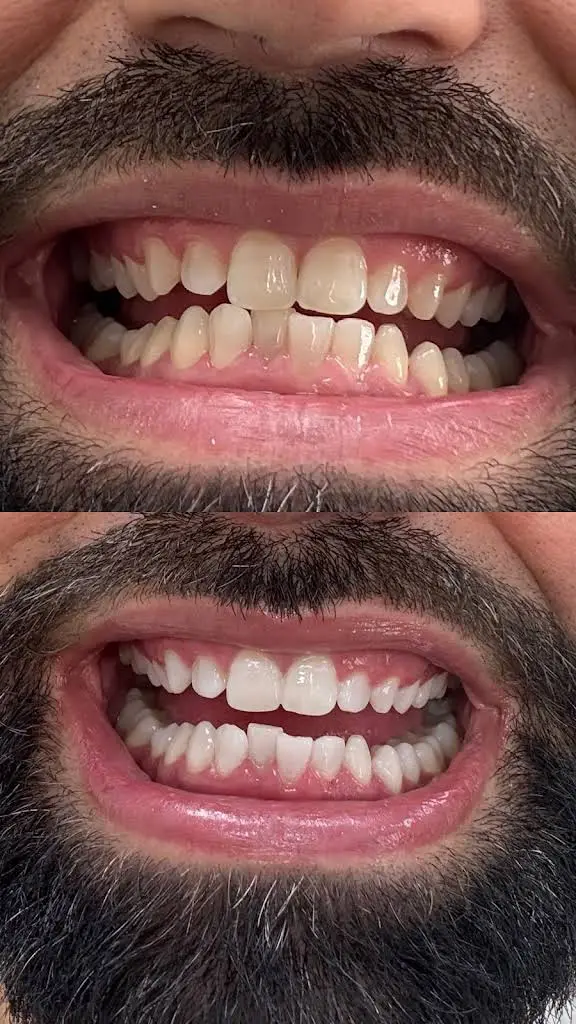 Dental Aesthetics of North Andover