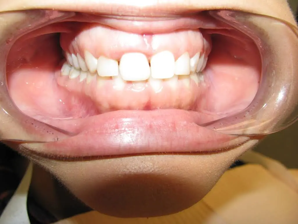 Family & Cosmetic Dentistry of North Andover