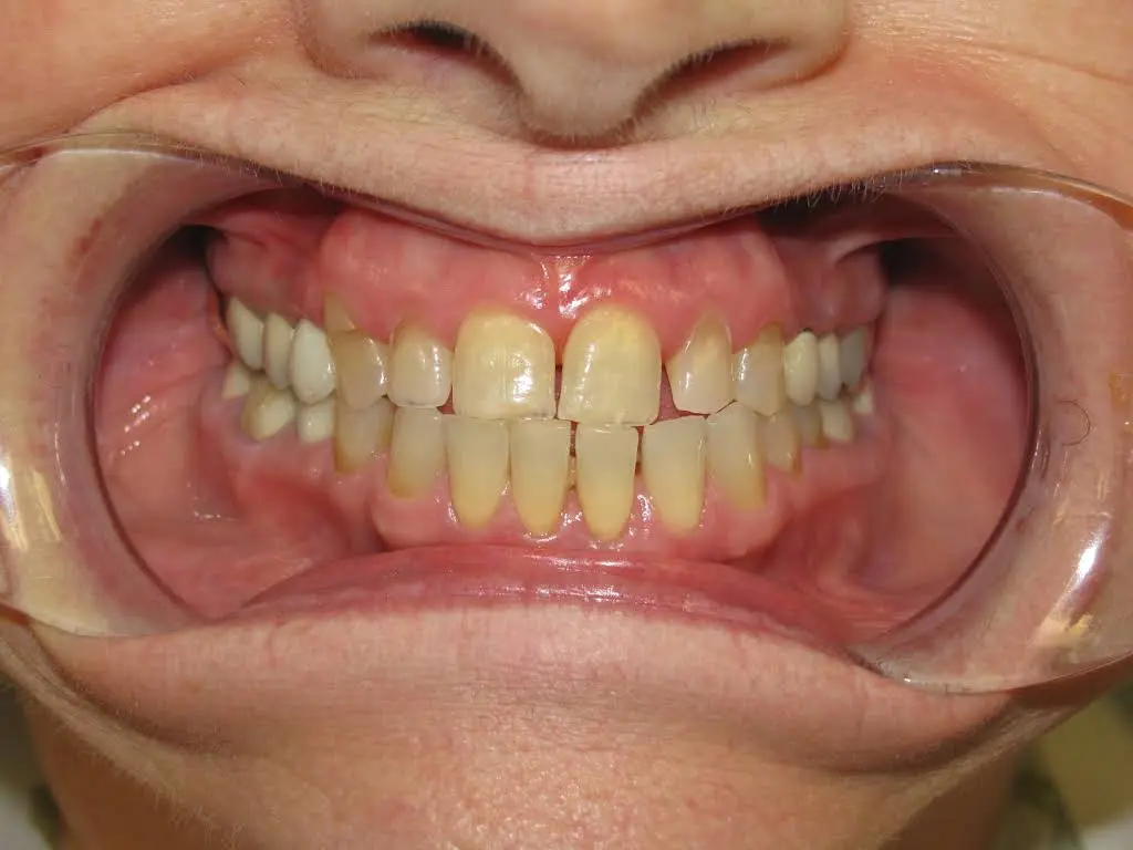 Family & Cosmetic Dentistry of North Andover