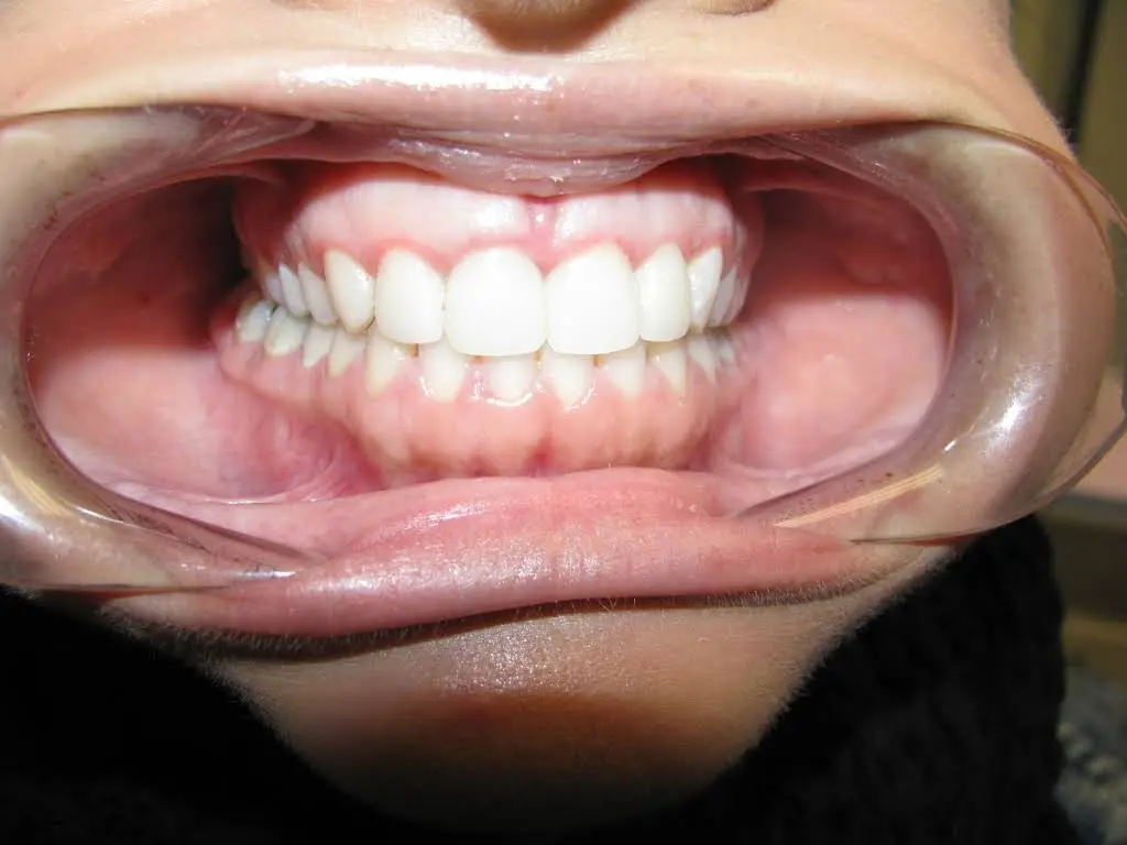 Family & Cosmetic Dentistry of North Andover