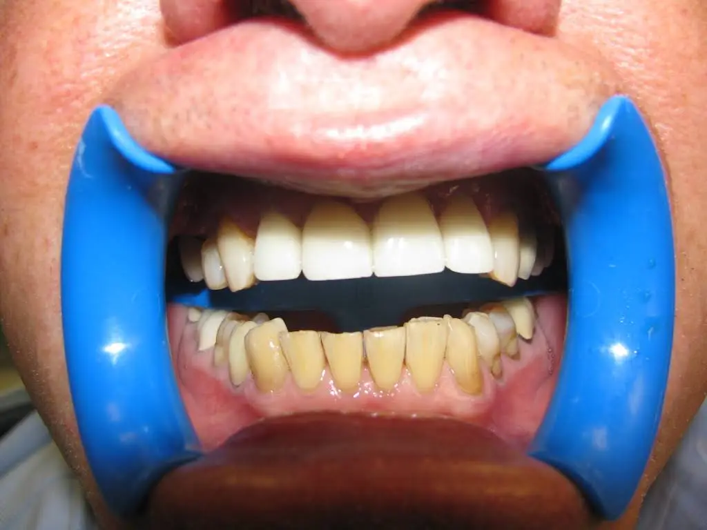 Family & Cosmetic Dentistry of North Andover