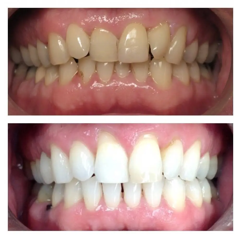 Aesthetic Dental Care