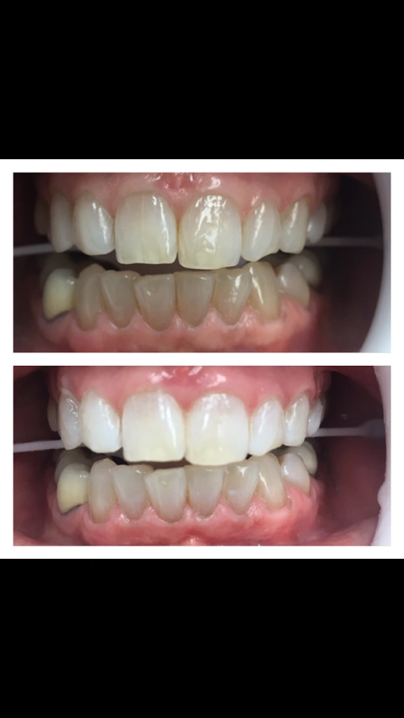 Aesthetic Dental Care