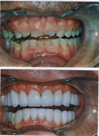 Aesthetic Dental Care
