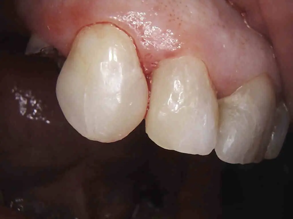 Osterville Family Dental
