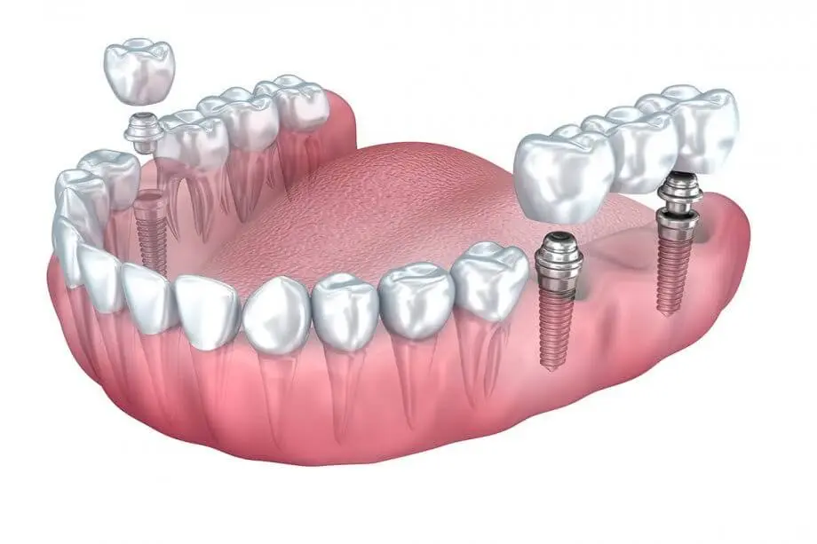 Smiley Dental Beverly