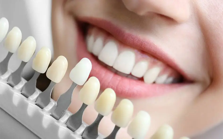 Smiley Dental Beverly