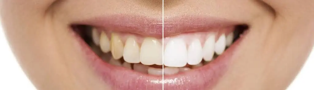 Prime Dental