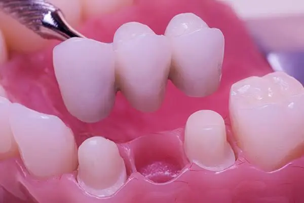 Georgetown Dental Partners