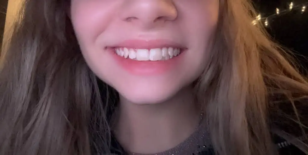 Aspen Dental