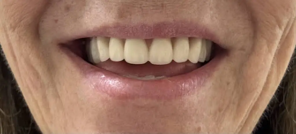 Aspen Dental