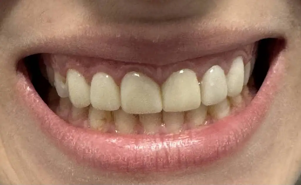 Gentle Dental