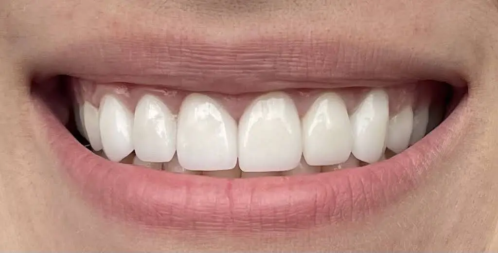 Gentle Dental