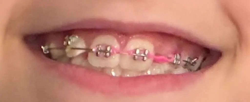 Lilac Kids Pediatric Dentistry
