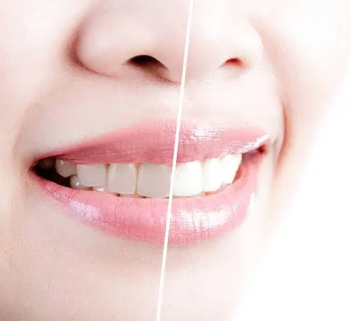 Evergreen Dental Care