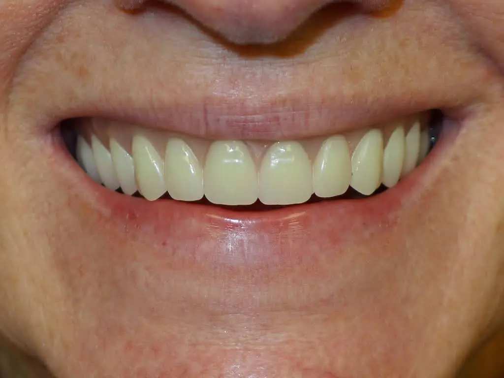 Evergreen Dental Care