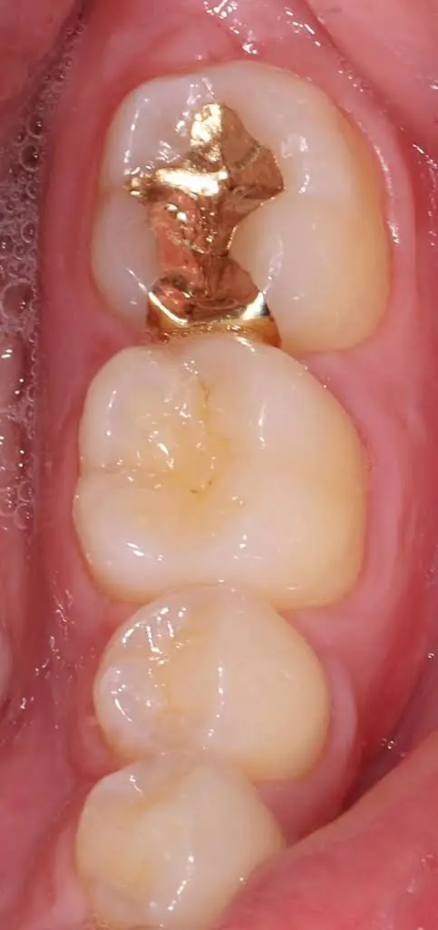 Locust Street Dental Center