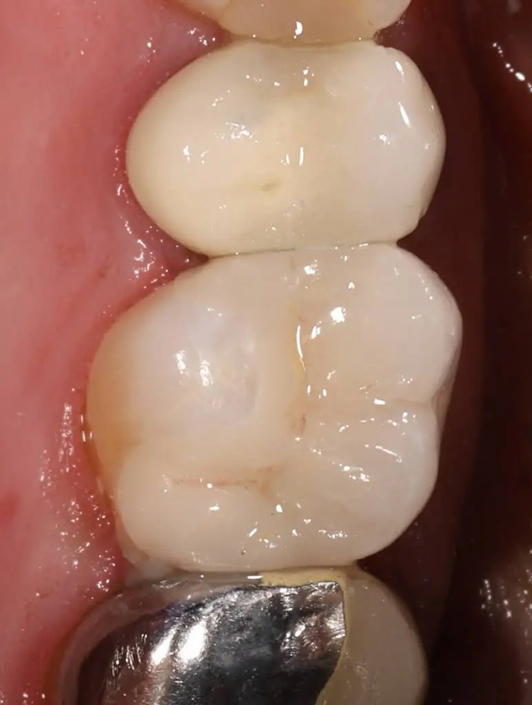 Locust Street Dental Center